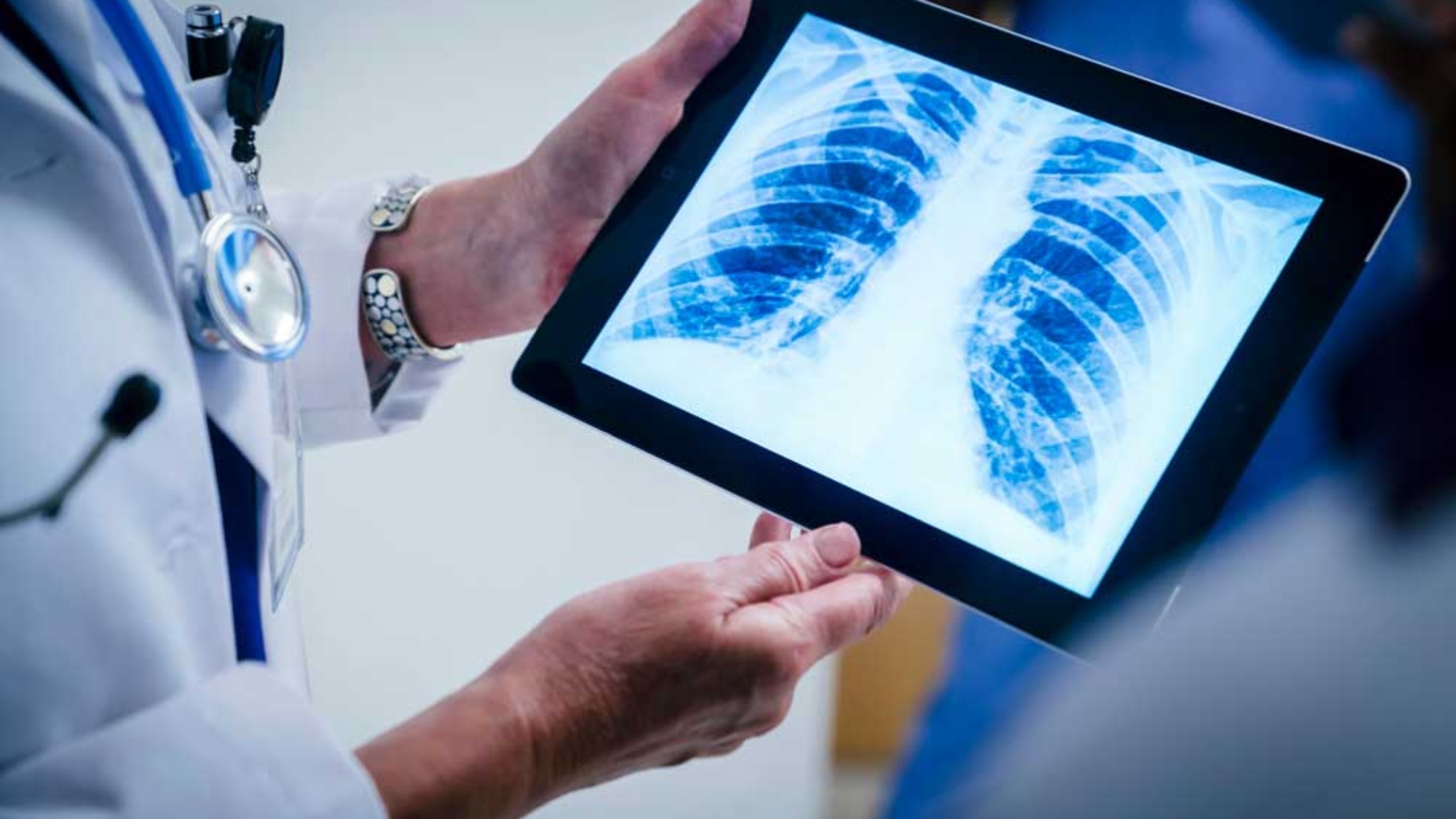 Doctor-holding-image-of-chest-xray