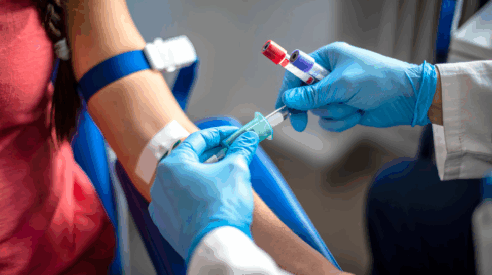 Πόσο Συχνά Πρέπει να Κάνετε Εξετάσεις Αίματος;