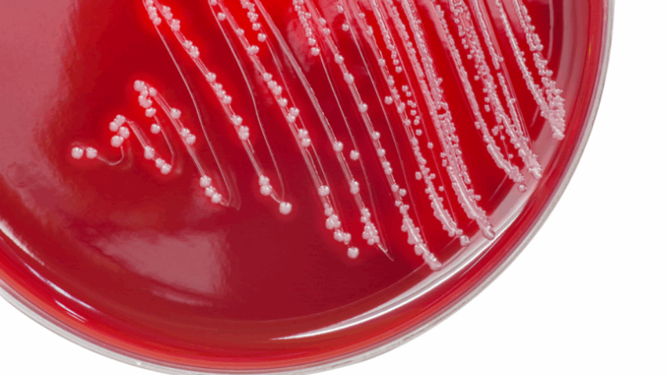 στρεπτόκοκκος