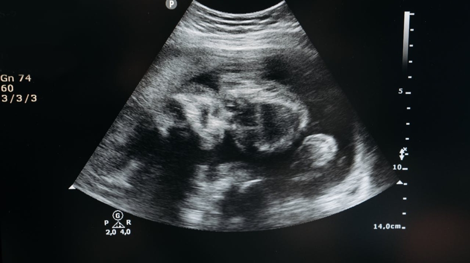 pexels-pavel-danilyuk-7108416